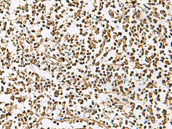 UBLCP1 Polyclonal Antibody (E-AB-52227)