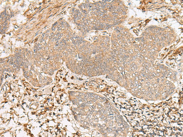 FBXW8 Polyclonal Antibody (E-AB-17953)