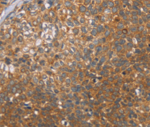CCL21 Polyclonal Antibody (E-AB-13982)