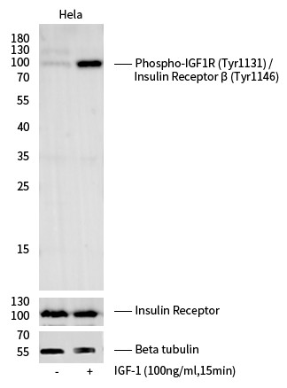 Recombinant Phospho-IGF1R (Tyr1131)/Insulin Receptor β (Tyr1146) Monoclonal Antibody (AN300051L)