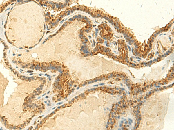 MTHFS Polyclonal Antibody (E-AB-52848)
