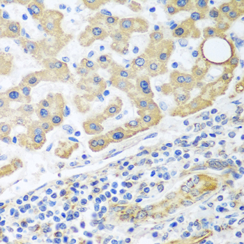 GLUD1 Polyclonal Antibody (E-AB-62764)