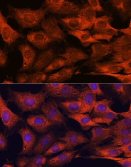 MALT1 Polyclonal Antibody (E-AB-60635)