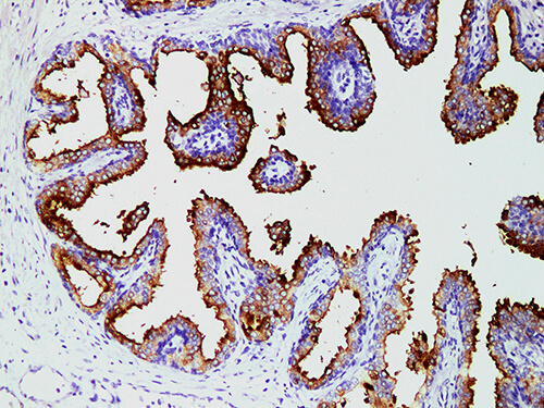 PSMA Monoclonal Antibody (ELAB6093-M)