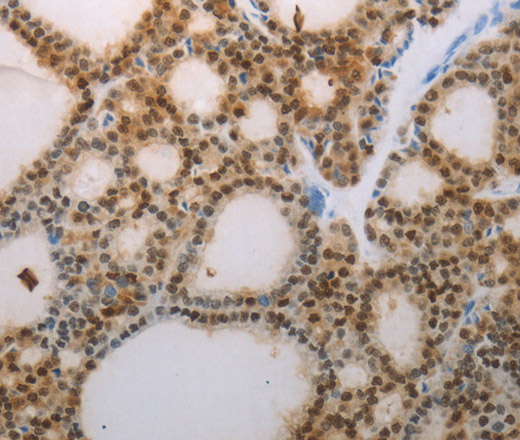 S100A1 Polyclonal Antibody (E-AB-15839)