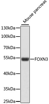 FOXN3 Polyclonal Antibody (E-AB-66401)
