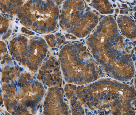 SNCG Polyclonal Antibody (E-AB-13850)