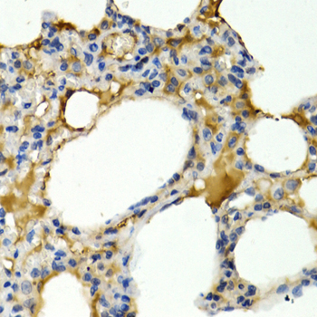 IL9 Polyclonal Antibody (E-AB-63712)