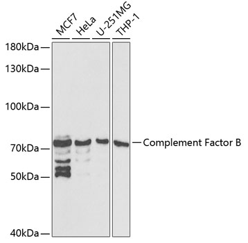 Complement Factor B Polyclonal Antibody (E-AB-67031)