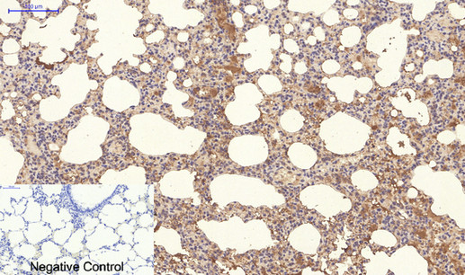NBR1 Monoclonal Antibody (E-AB-22148)