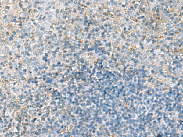 EMILIN1 Polyclonal Antibody (E-AB-19245)