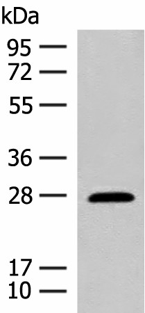 GUCA1B Polyclonal Antibody (E-AB-19902)