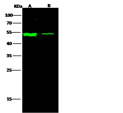 Recombinant IFNAR2 Monoclonal Antibody (AN300327P)