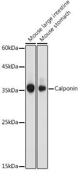 Calponin Polyclonal Antibody (E-AB-91599)