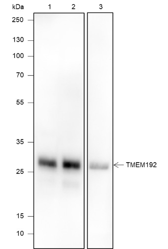 Recombinant TMEM192 Monoclonal Antibody (AN301887L)