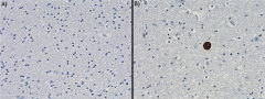 Biotin anti-α-Synuclein, 103-108 Antibody (807807)