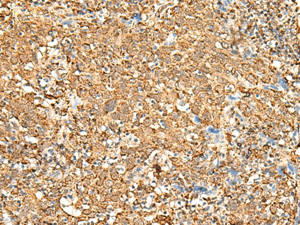 P2RY14 Polyclonal Antibody (E-AB-18016)