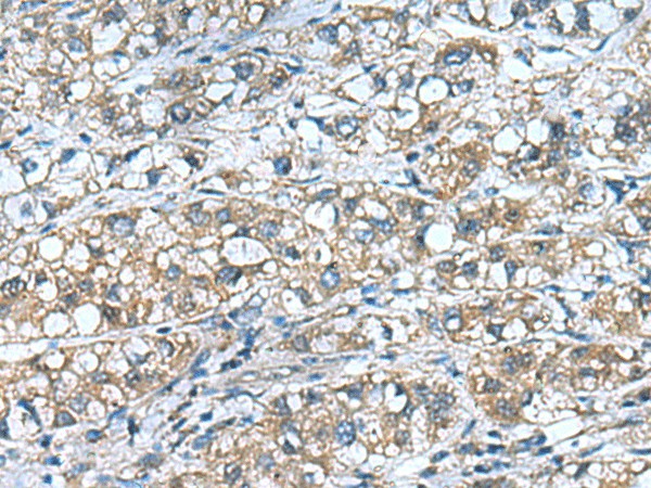 COMMD9 Polyclonal Antibody (E-AB-53075)