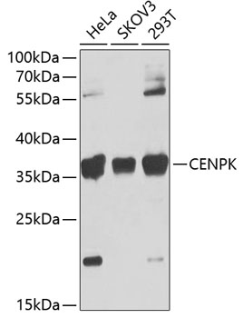 CENPK Polyclonal Antibody (E-AB-63163)