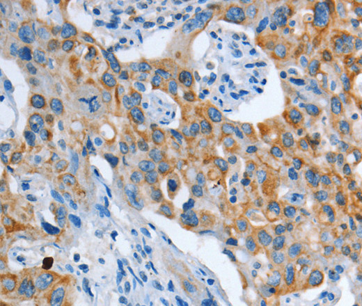 ASL Polyclonal Antibody (E-AB-14601)