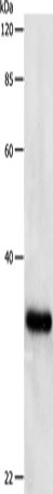 PCNA Polyclonal Antibody (E-AB-10010)