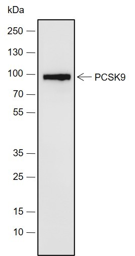 Recombinant PCSK9 Monoclonal Antibody (AN301958L)