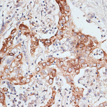 PIGR Polyclonal Antibody (E-AB-67728)