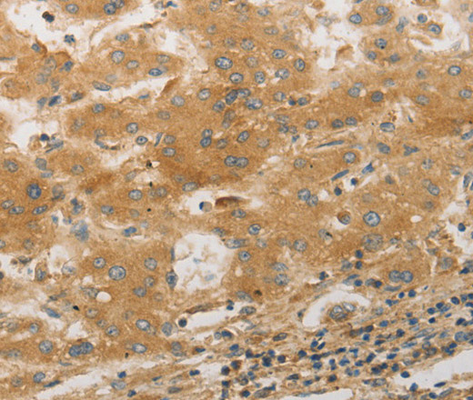 PLPP1 Polyclonal Antibody (E-AB-12610)