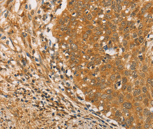 ARMCX3 Polyclonal Antibody (E-AB-10840)