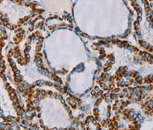 CMC4 Polyclonal Antibody (E-AB-11409)
