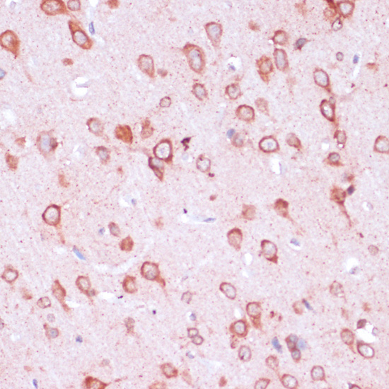 RPL21 Polyclonal Antibody (E-AB-64963)
