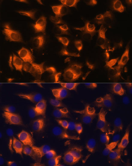 SSTR2 Polyclonal Antibody (E-AB-66424)