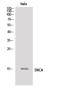 SNCA Polyclonal Antibody (E-AB-36111)