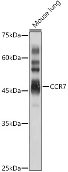 CCR7 Polyclonal Antibody (E-AB-90934)