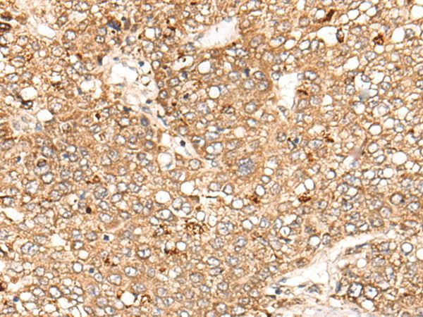 C1S Polyclonal Antibody (E-AB-17749)