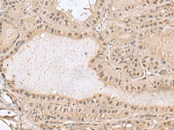 PCLAF Polyclonal Antibody (E-AB-19102)