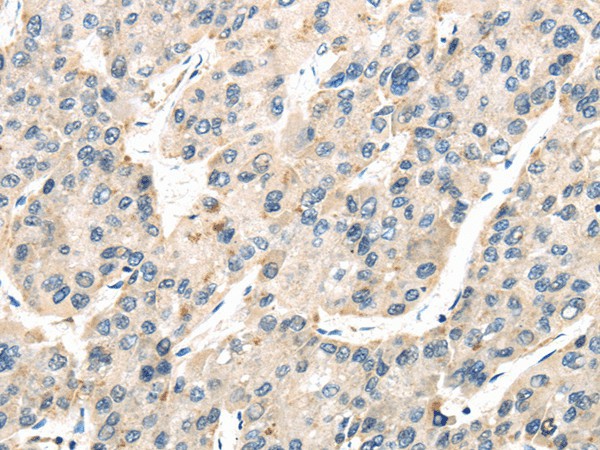 TXNIP Polyclonal Antibody (E-AB-17495)
