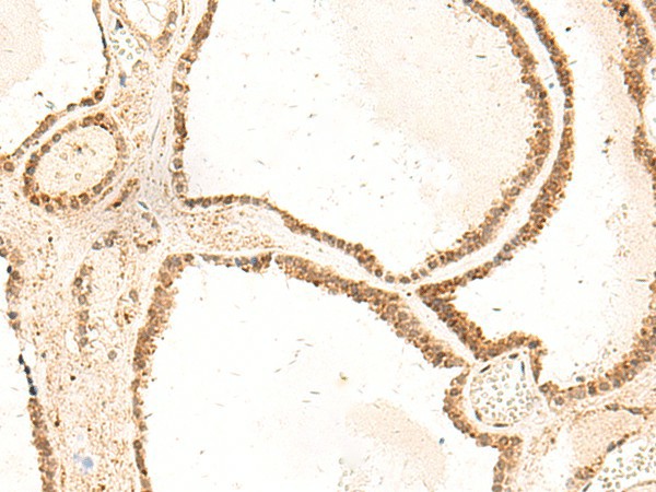 ZFYVE27 Polyclonal Antibody (E-AB-18989)