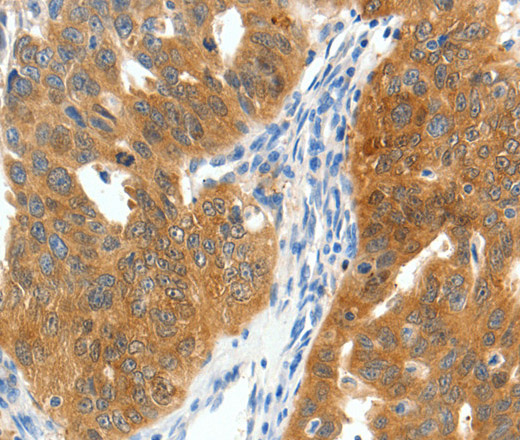 SCN9A Polyclonal Antibody (E-AB-16052)