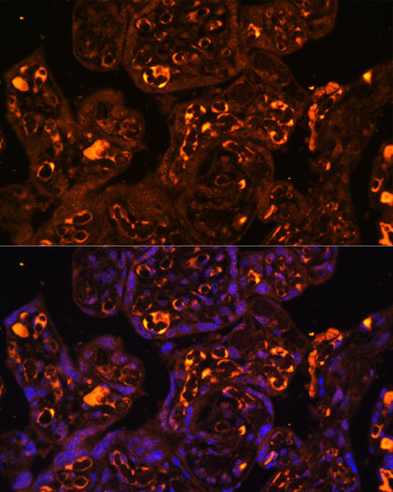 LAIR2 Polyclonal Antibody (E-AB-64991)