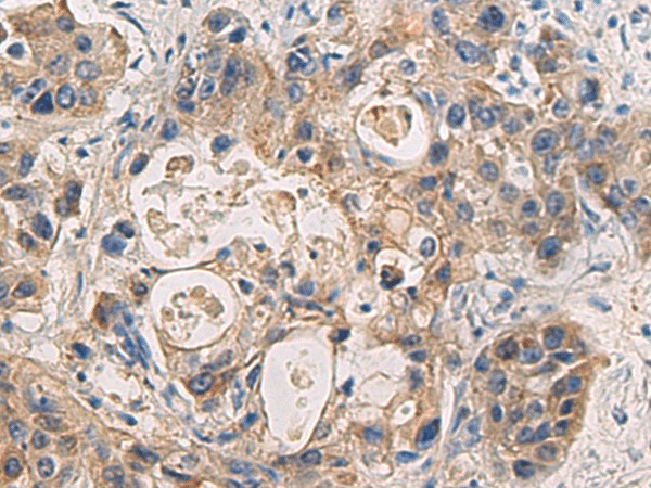 DMRTA2 Polyclonal Antibody (E-AB-17890)
