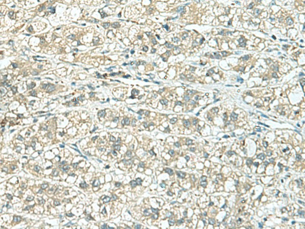 TENT5C Polyclonal Antibody (E-AB-52931)