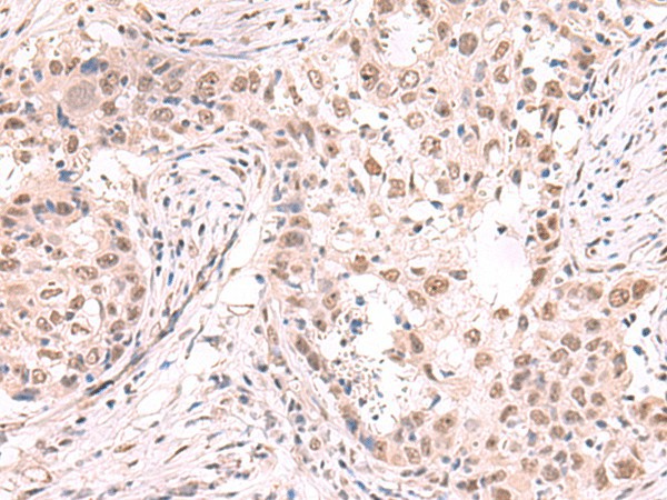 ZNF559 Polyclonal Antibody (E-AB-52985)