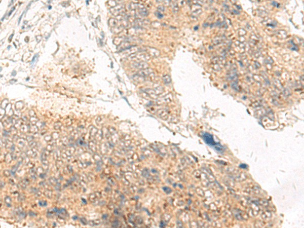IDUA Polyclonal Antibody (E-AB-52010)