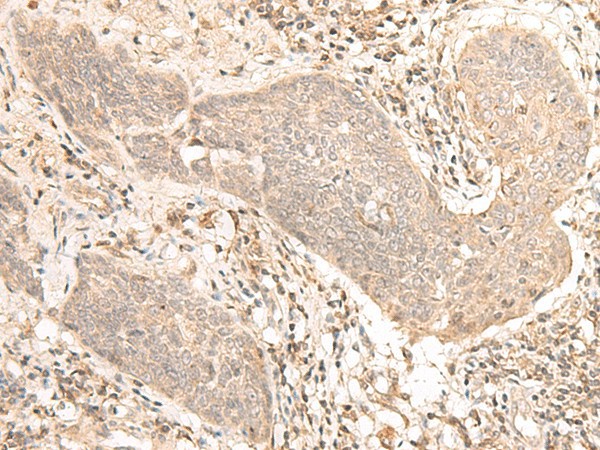 VPS50 Polyclonal Antibody (E-AB-19873)