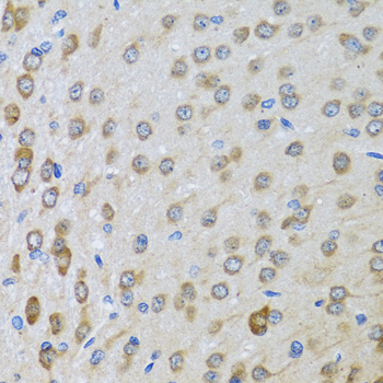 BTD Polyclonal Antibody (E-AB-62646)
