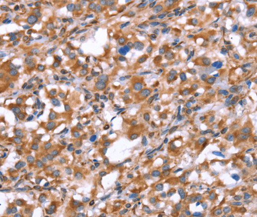 GPC6 Polyclonal Antibody (E-AB-13271)
