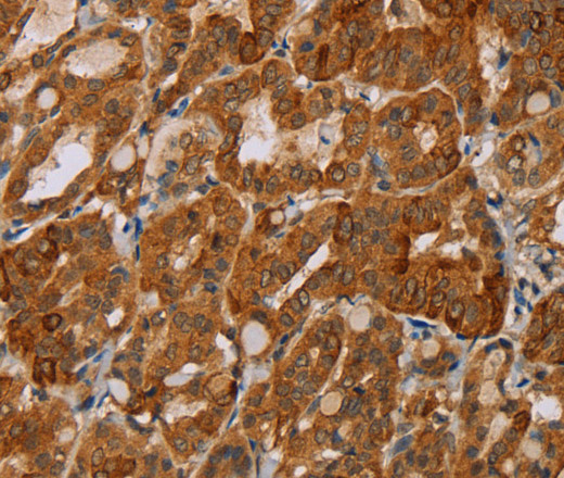 MTUS1 Polyclonal Antibody (E-AB-11413)
