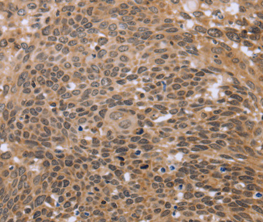 ERCC6L Polyclonal Antibody (E-AB-14995)