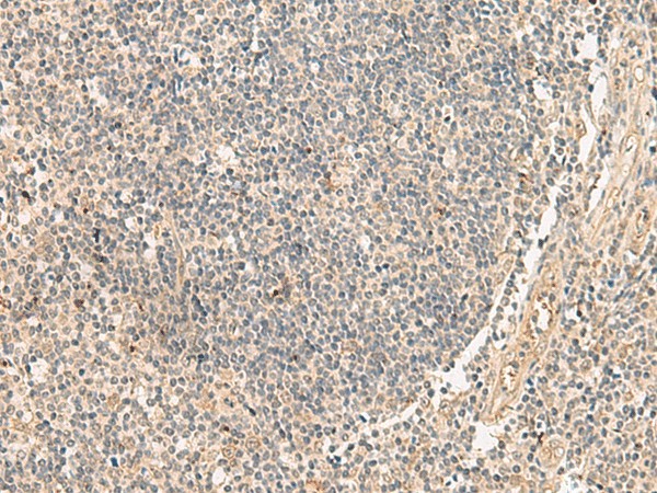 PAF1 Polyclonal Antibody (E-AB-18844)
